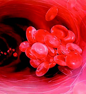 Риск венозной  тромбоэмболии  у пациентов  с подагрой