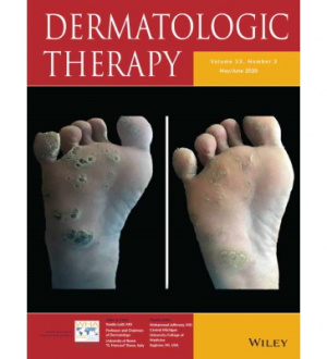 Can decreased monocyte to HDL-cholesterol ratio be a marker indicating the anti-inflammatory effect of the colchicine in Behçet’s Disease? A preliminary study