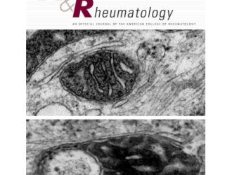 Значительное снижение уровня мочевой кислоты в сыворотке с помощью уратснижающей терапии при подагре с проявлениями эрозивного артрита: рандомизированное двойное слепое контролируемое исследование