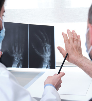 Безопасность и эффективность метотрексата при комбинированной терапии у пациентов с ранним ревматоидным артритом: апостериорный анализ рандомизированного контролируемого исследования