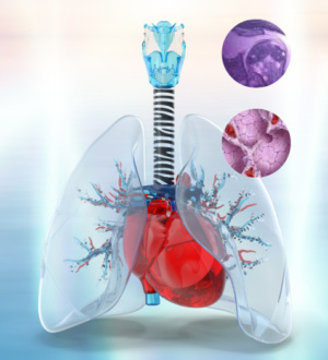13 апреля — Всемирный день распространения информации о саркоидозе