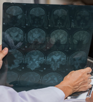 Руководство 2023 года Американского колледжа ревматологов (ACR) и Американского колледжа врачей-пульмонологов (CHEST) по скринингу и мониторингу интерстициальных заболеваний легких у людей с системными аутоиммунными ревматическими заболеваниями