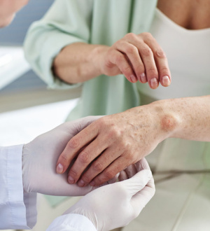 Гидроксихлорохин при дискоидной красной волчанке: снижает ли он риск развития СКВ? Длительное наблюдательное исследование