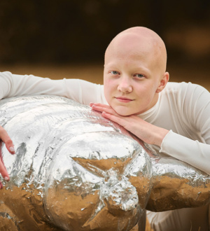 Безопасность биологической и таргетной терапии: риск злокачественных новообразований у пациентов с ревматическими заболеваниями