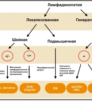 Лимфаденопатия в ревматологической практике: прагматичный подход